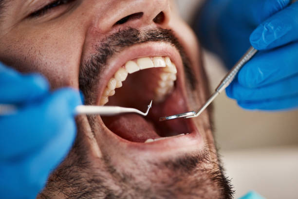 Full Mouth Reconstruction in Crompond, NY